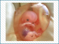 Pregnancy Stages