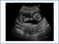 Pregnancy Stages