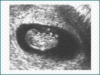 Pregnancy Stages