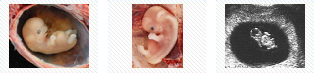 Pregnancy Stages